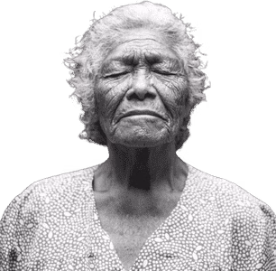 Picture of an elderly lady depicting dementia - Almonds and Olivez